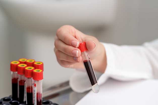 Какие гормоны можно определить при анализе крови?
