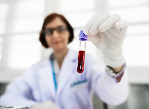 Как правильно подготовиться к анализу на ТТГ перед сдачей крови
