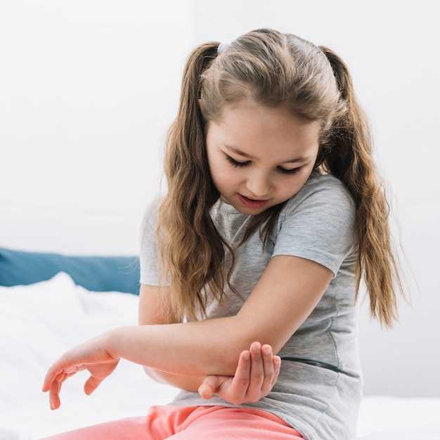 Что такое аллергическая сыпь у ребенка?
