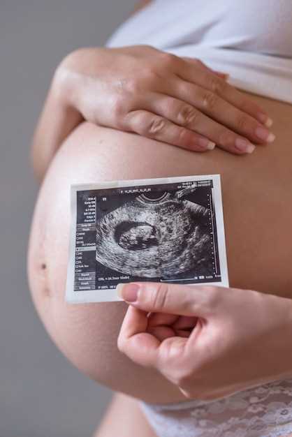 Ультразвуковая диагностика на 18-20 неделях беременности