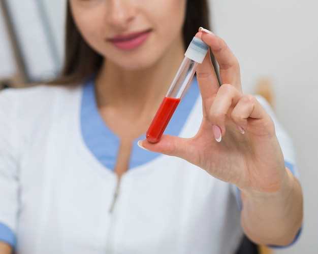 Повышение эритроцитов в крови: причины и последствия