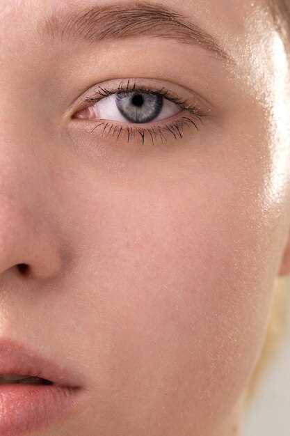 Почему появляется шелушение кожи вокруг глаз?