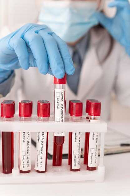 Значение результатов анализа крови Roma1: норма и отклонения